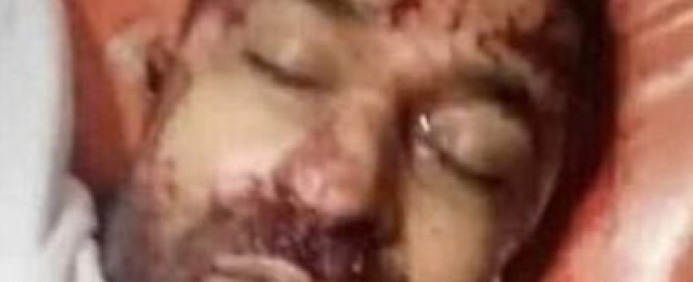 الجيش الليبى يعلن مقتل قائد ميليشيا سورية مدعوم من تركيا بالعاصمة طرابلس