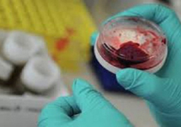 أسيوط ترفع درجة الاستعداد للوقاية من فيروس كورونا