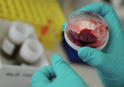 صحة الأقصر تعلن سلبية نتائج تحليل حالة اشتباه بـ”كورونا”