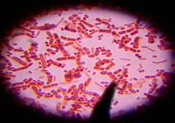 شبح الجمرة الخبيثة يهدد ولاية مونتانا الأمريكية