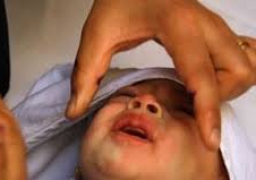 “الصحة”:تطعيم 4 .15 مليون طفل ضد “شلل الأطفال” بنهاية اليوم الثالث للحملة