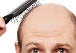 وداعًا للصلع.. نجاح تجارب أحدث علاج للصلع الوراثي