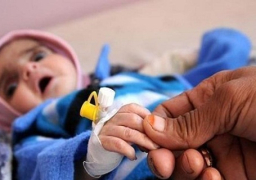 الكوليرا تصيب طفلا يمنيا كل 6 دقائق