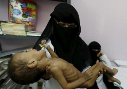 الأمم المتحدة: اليمن على حافة الوقوع في مجاعة