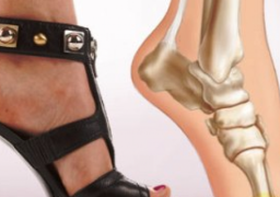 لكى سيدتى … 6 طرق للتغلب على ألم القدمين بعد ارتداء الكعب العالى