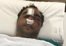 عابد يتوجه للكويت للإطمئنان على المصري المعتدى عليه