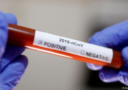 الصحة: لا توجد خدمة إجراء تحليل فيروس كورونا بالمنازل