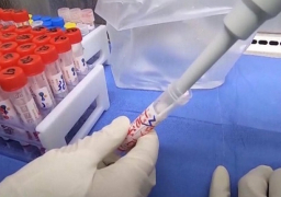 جامعة أدنبرة الاسكتلندية تعلن اكتشاف طفرة جديدة لكورونا في 13 دولة فى 5 قارات