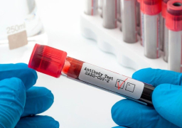 أوكرانيا تسمح للأجانب الحاصلين على لقاح كورونا بدخول أراضيها