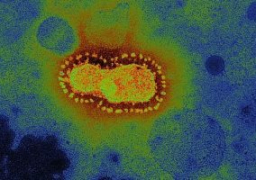 ماليزيا: 20 ألفا و837 إصابة جديدة بفيروس كورونا