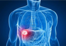 الصحة: علاج 90 ألف مواطن مجانا ضمن برنامج “متابعة مرضى التليف الكبد”