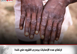 ارتفاع عدد الإصابات بجدرى القرود في كندا