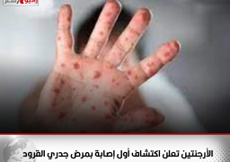 الأرجنتين تعلن اكتشاف أول إصابة بمرض جدري القرود