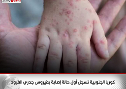 كوريا الجنوبية تسجل أول حالة إصابة بفيروس جدري القرود