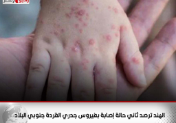 الهند ترصد ثاني حالة إصابة بفيروس جدري القردة جنوبي البلاد