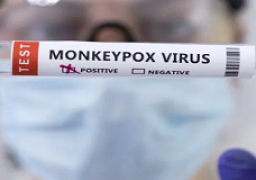 الإمارات تعلن تسجيل 3 حالات لجدري القردة