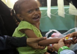 تقرير أممي: نصف مليون طفل يواجهون سوء التغذية الحاد في اليمن