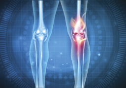 طقطقة المفاصل قد تكون مؤشرا على أمر خطير