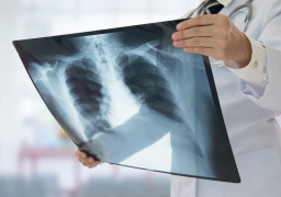 علاج قد يقتل السرطان .. الحل قادم من الفضاء