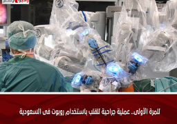 للمرة الأولى.. عملية جراحية للقلب باستخدام روبوت فى السعودية
