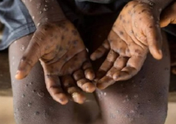 الصحة العالمية: جدري القرود لن يؤدي إلي الاغلاق الدولي